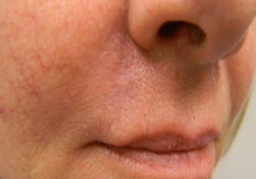 Lips-2